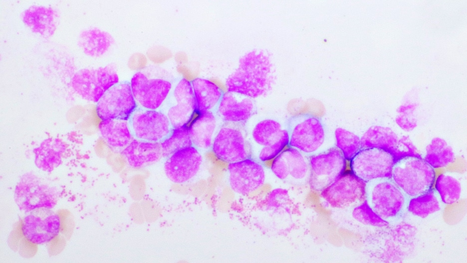 myeloid cells