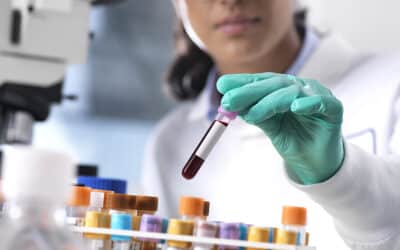 Can ctDNA Testing Help Personalize Osteosarcoma Treatment?