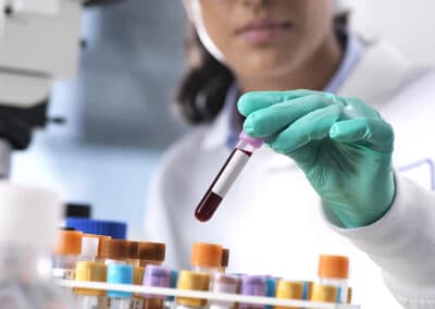 Can ctDNA Testing Help Personalize Osteosarcoma Treatment?