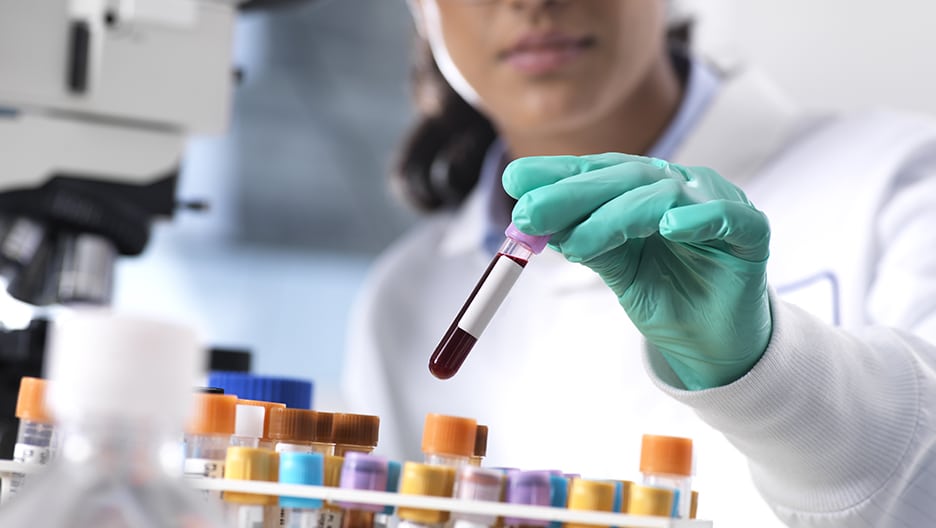 Researcher holding a test tube of blood