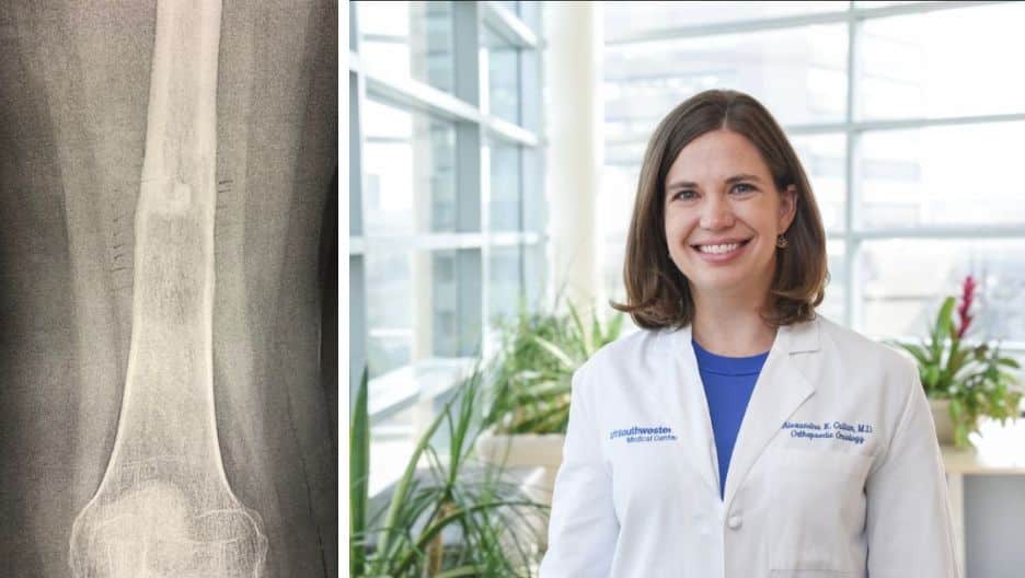 Split screen of a bone x-ray and a headshot of orthopedic surgeon Dr. Callan